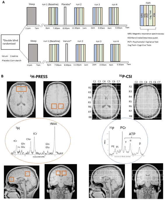 Single dose creatine improves cognitive performance and induces changes in cerebral high energy phosphates during sleep deprivation - Featured Image