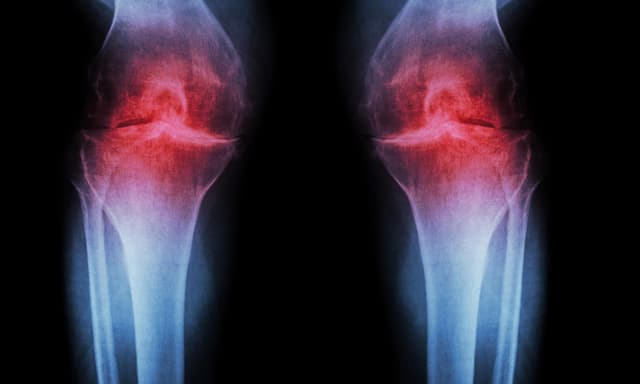 Scientists restore knee cartilage using targeted injection - Earth.com - Featured Image