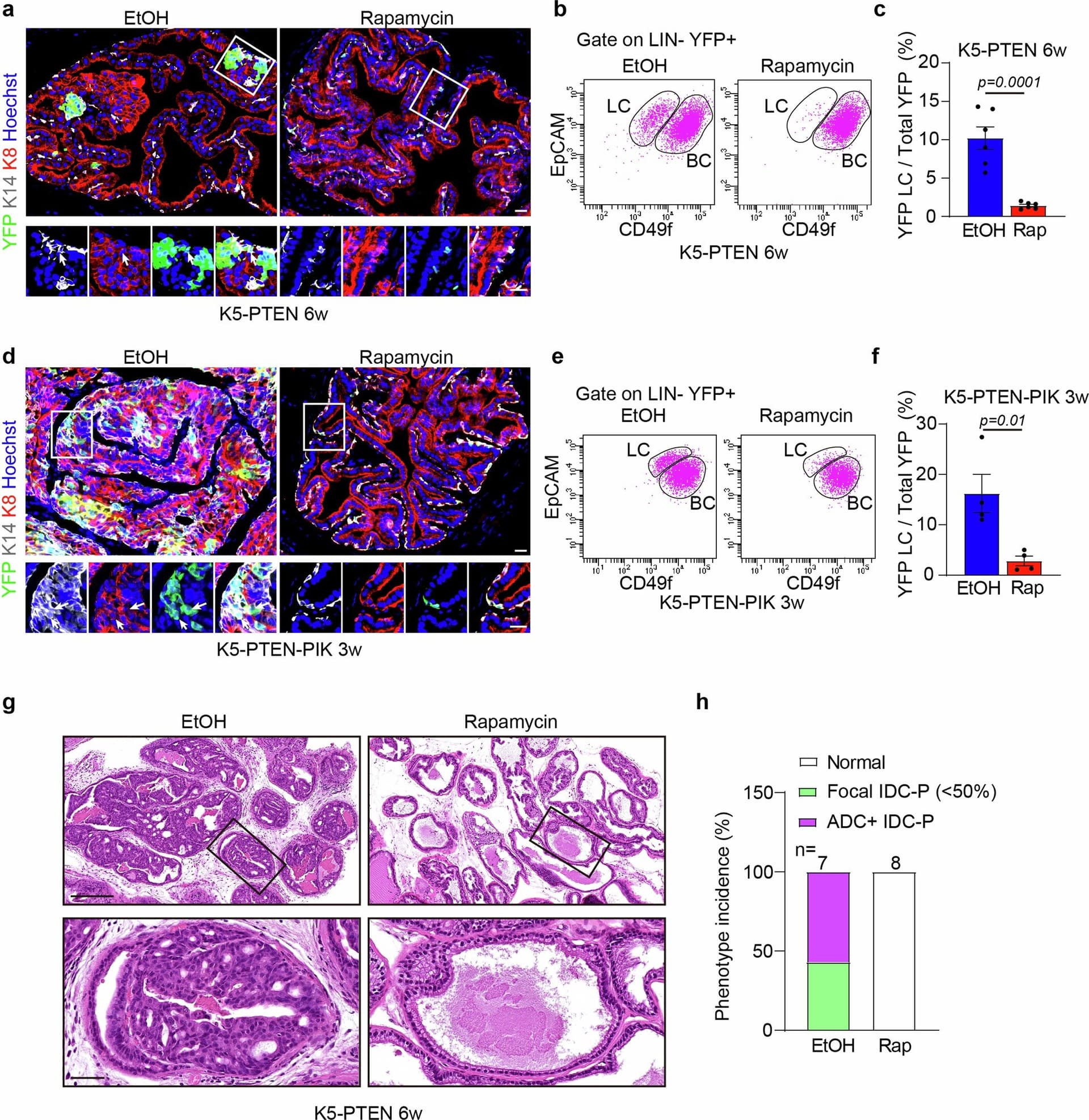 How inflammation drives prostate tumor formation - Featured Image