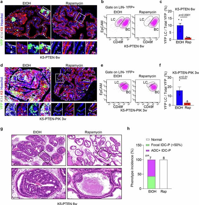 How inflammation drives prostate tumor formation - Featured Image