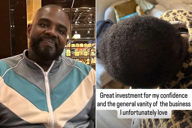 Comedian Ron Funches Reveals He Was in the 'Shedding Phase’ of Hair Transplant While Filming Traitors: 'Whoops' - Featured Image