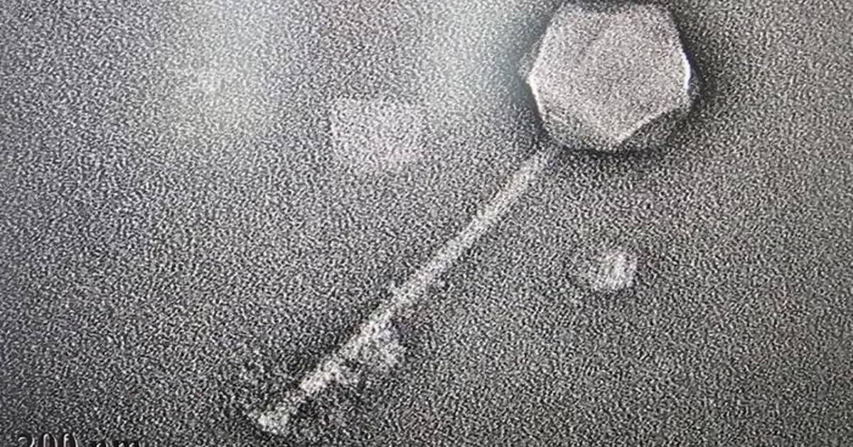 AI-designed bacteriophages reportedly used to treat antibiotic ...