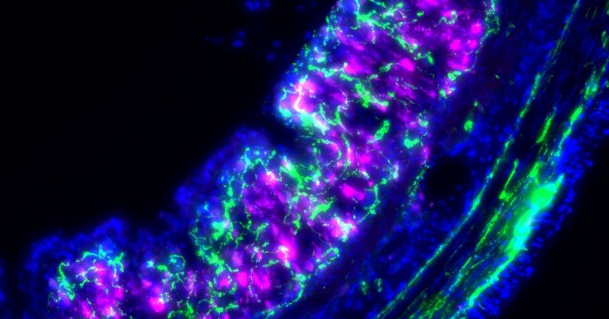 Mechanical sensing by gut immune cells linked to colitis-associated ...