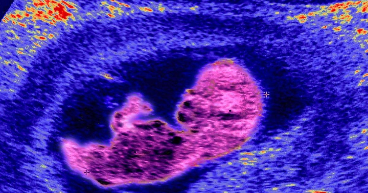 Cells from mothers may persist in the brain into old age · Digg